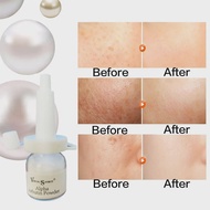 Alpha Arbutin Powder Arbutin Whitening Powder