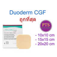 DuoDerm CGF แบบหนา (ราคาต่อ 1 แผ่น)