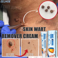 EELHOE Warts Remover Original Cream 20g Natural Herbal Ingredients Warts Treatment Wart Removal Cream Mole Remover for Unwanted Mole Skintags and Warts Remover