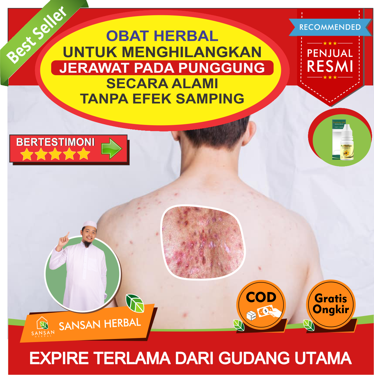 Harga Jerawat Punggung Salep Terbaru Juli 2022 Biggo Indonesia