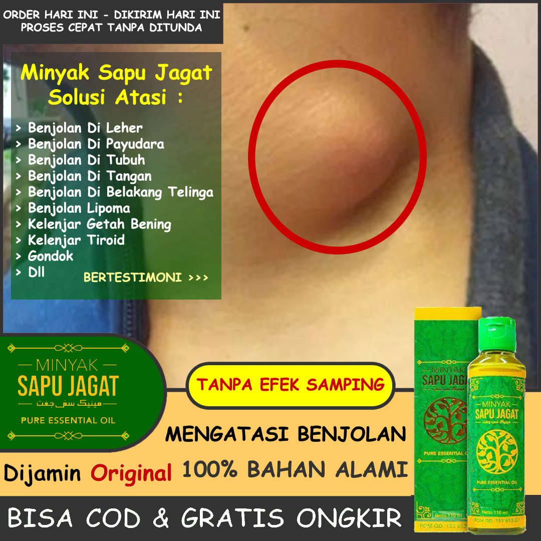 Harga Lipoma Herbal Terbaru April 2022 Biggo Indonesia