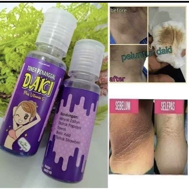 Hilangkan Daki Celah Paha Price Promotion Nov 2021 Biggo Malaysia