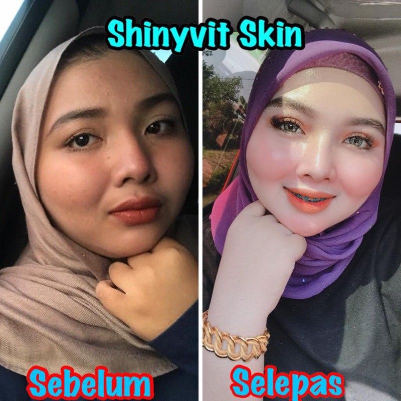 Shinyvit Skin Viral Price & Promotion - Jan 2022 BigGo Malaysia